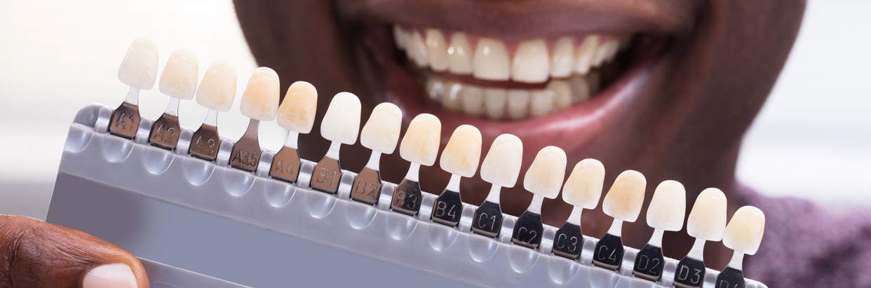 buildup dental